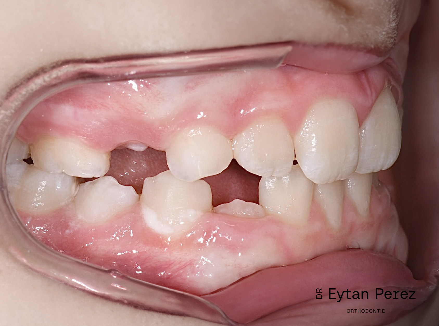 cas-16-c-droit-apres