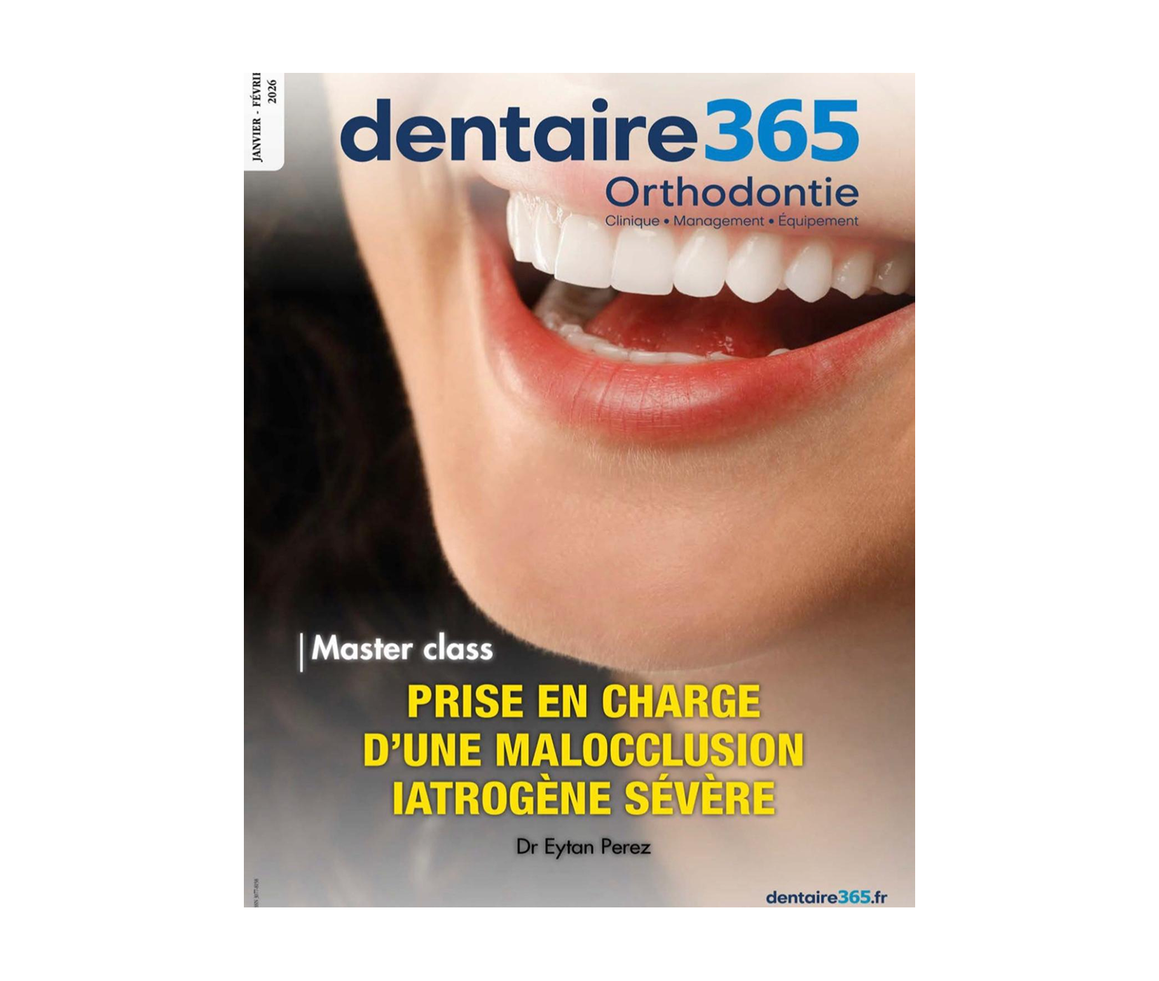 Masterclass : Prise en charge d&rsquo;une malocclusion iatrogène sévère